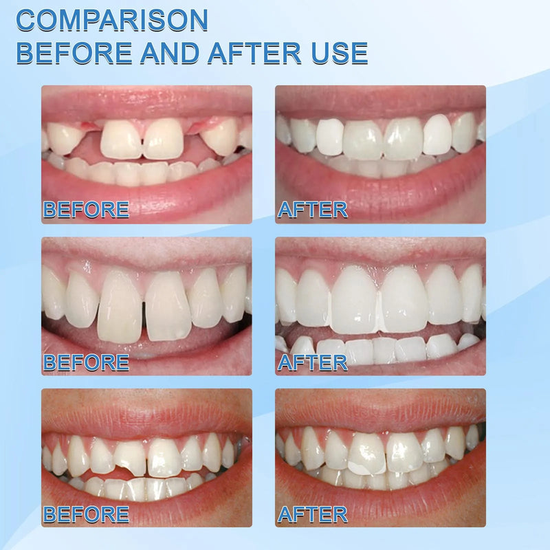 Restaurador Dental Smile®